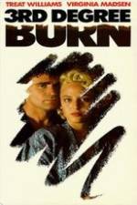 Watch Third Degree Burn Gomovies