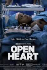 Watch Open Heart Gomovies