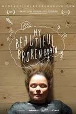 Watch My Beautiful Broken Brain Gomovies